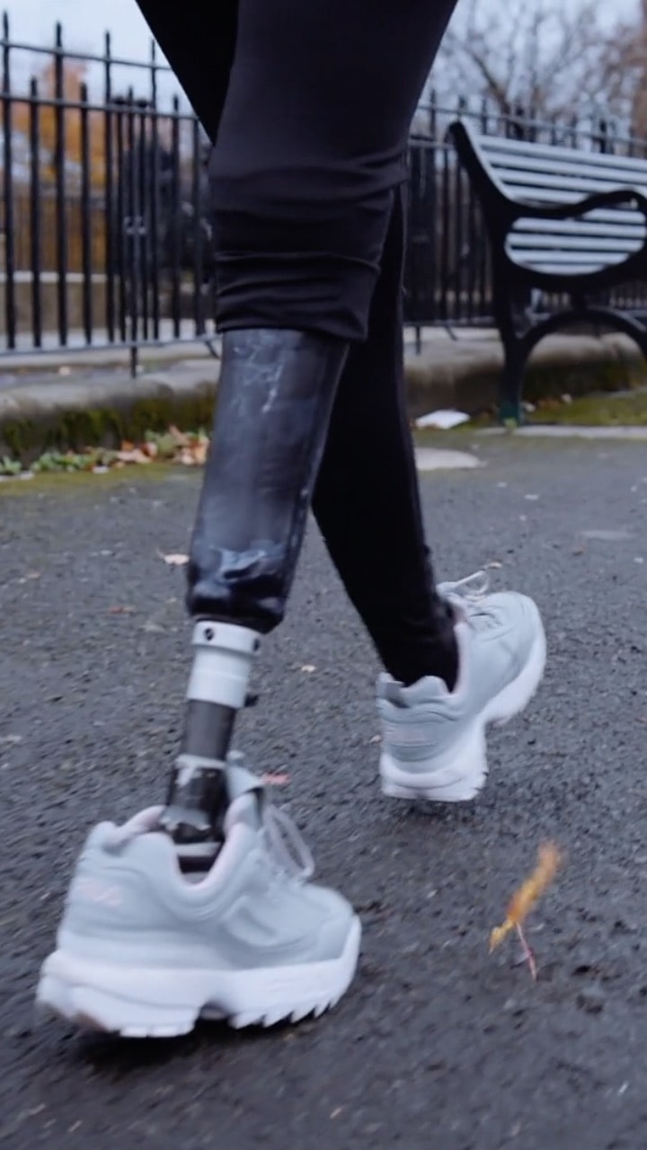 An image of a young woman walking on concrete - she is walking towards a bench in front of a metal fence. She is wearing white shoes and black leggings. The leg closest to the camera is a metal prosthetic.